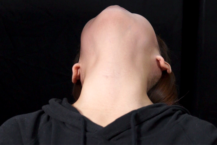 女性の首・喉・首絞め　サンプル画像02