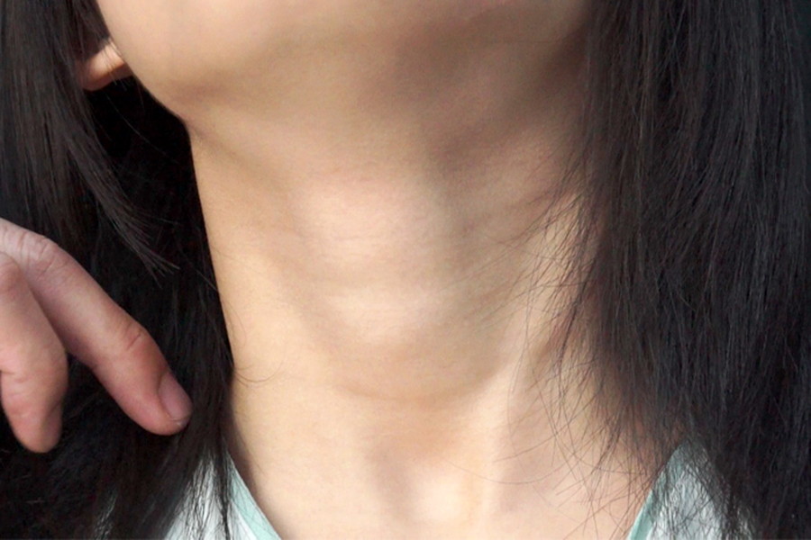 女性の首・喉・首絞め　サンプル画像02