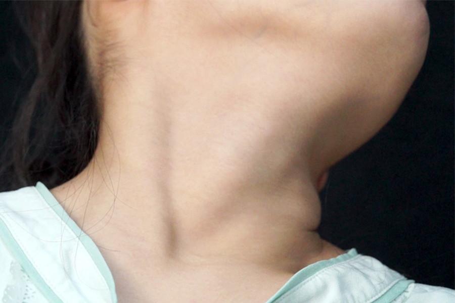 女性の首・喉・首絞め　サンプル画像04