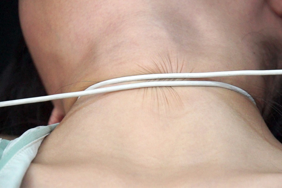 女性の首・喉・首絞め　サンプル画像09