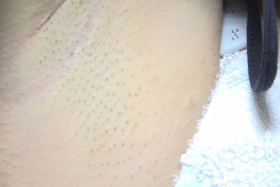 ワキ観察 黒髪女子あみちゃんのジョリワキを接写 フェチ動画ダウンロードはabv ワキ観察 黒髪女子あみちゃんのジョリワキを接写 フェチ動画ダウンロードはabv