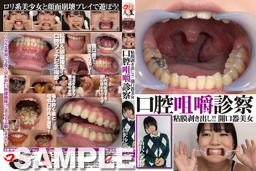 開口器　奴隷 